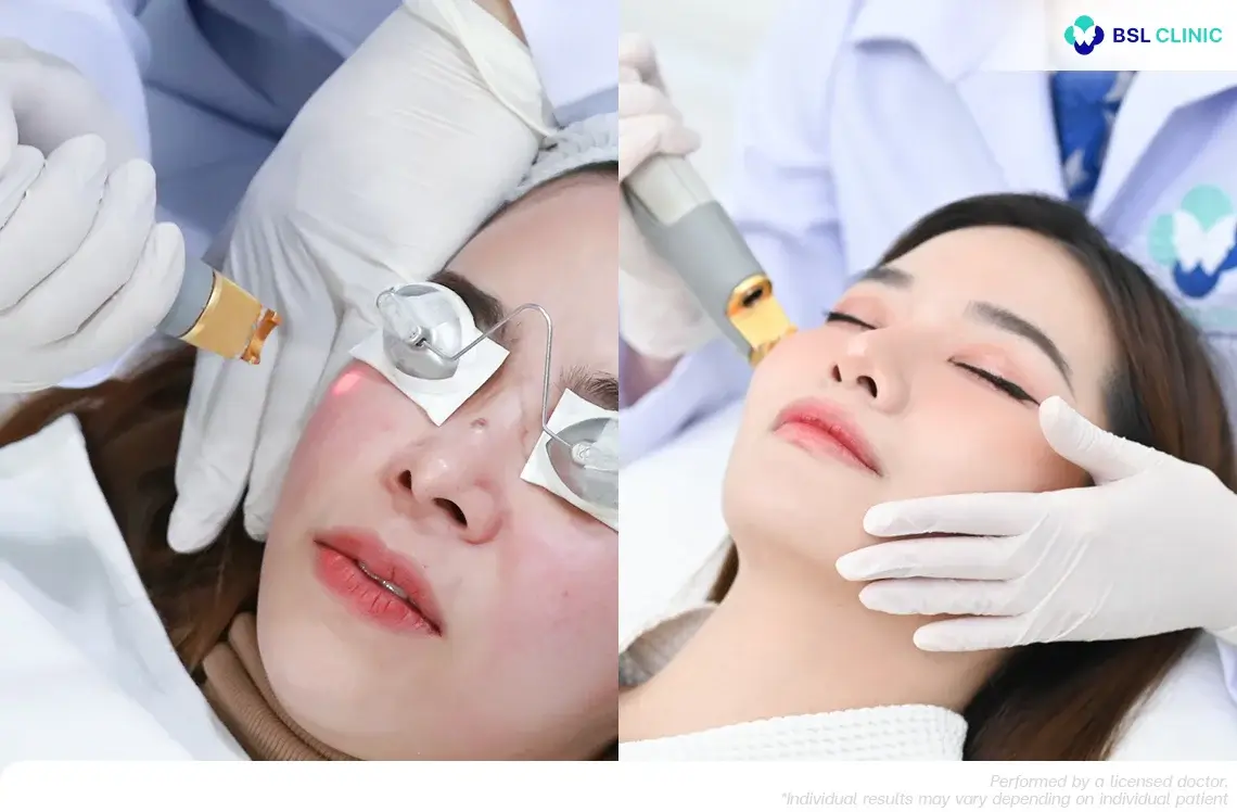 Vascular Laser + Laser Genesis