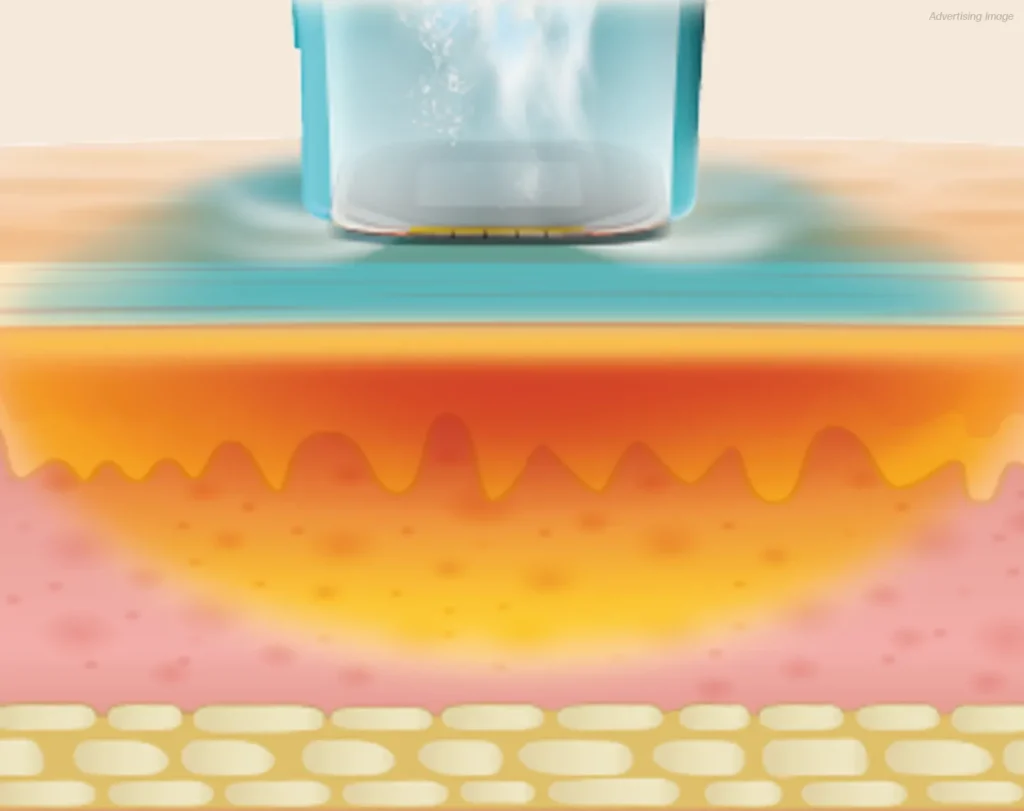 What-Is-the-Oligio-X