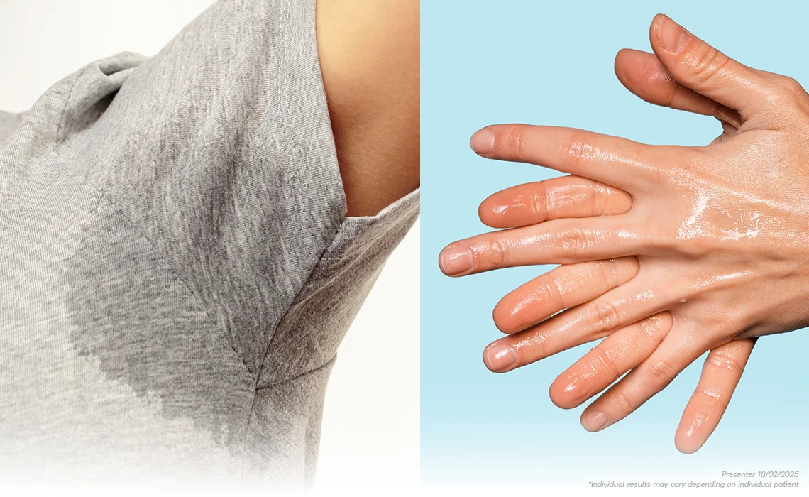 What is it Hyperhydrosis