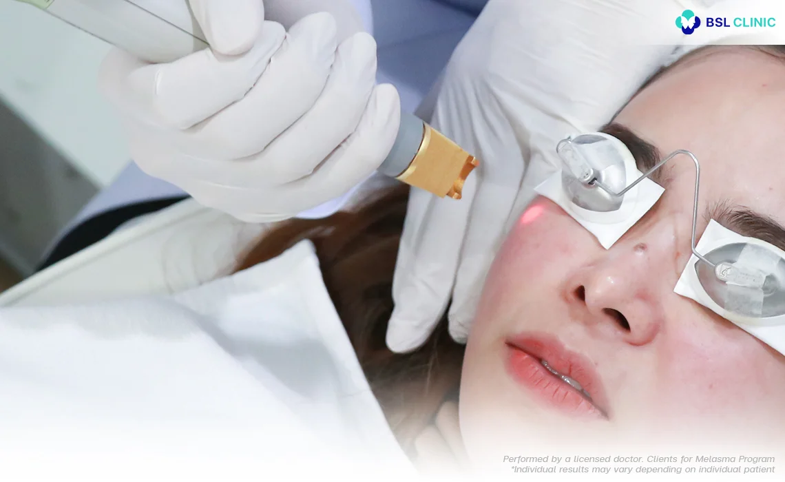 What is it Vascular Laser