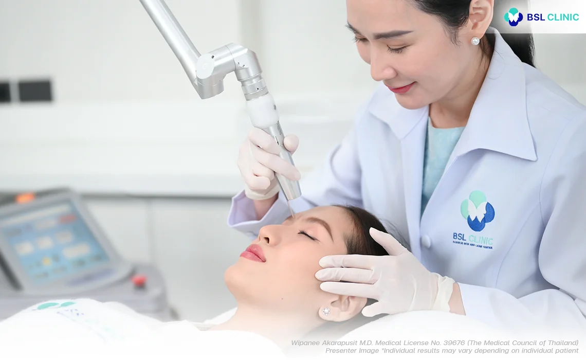 What to expect Pigmented Laser