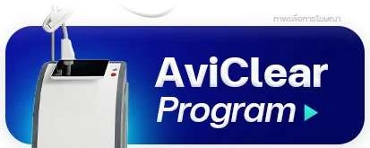 aviclear-เลเซอร์รักษาสิว
