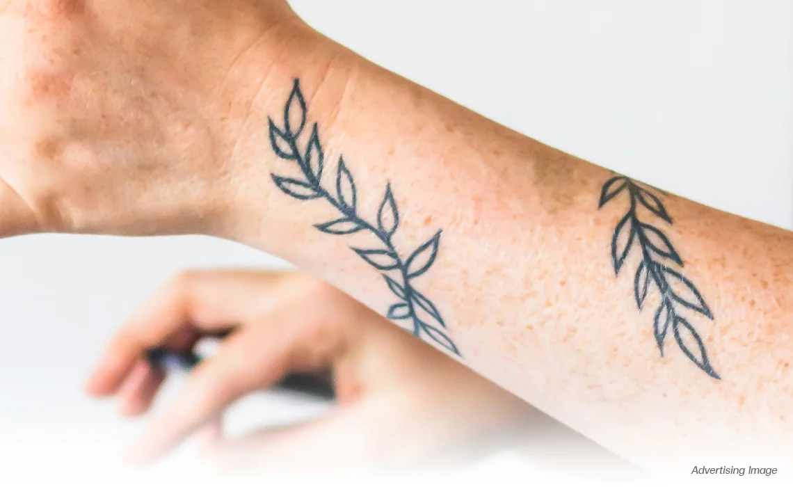 black grey Tattoo Removal