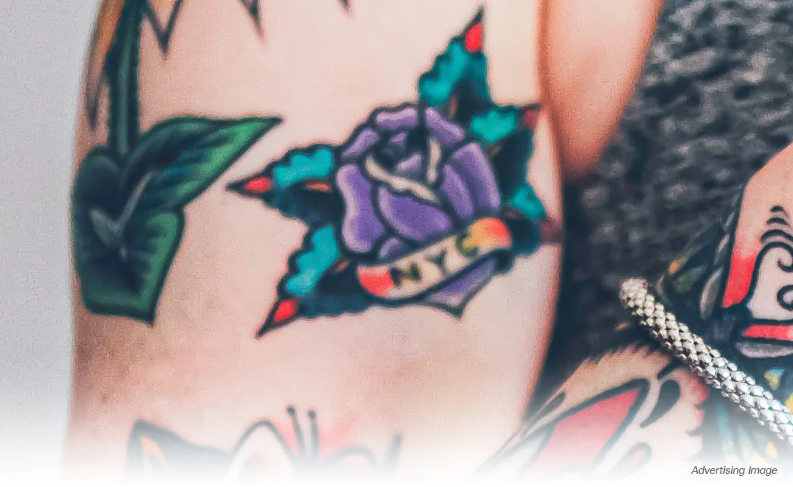 blue purple Tattoo Removal