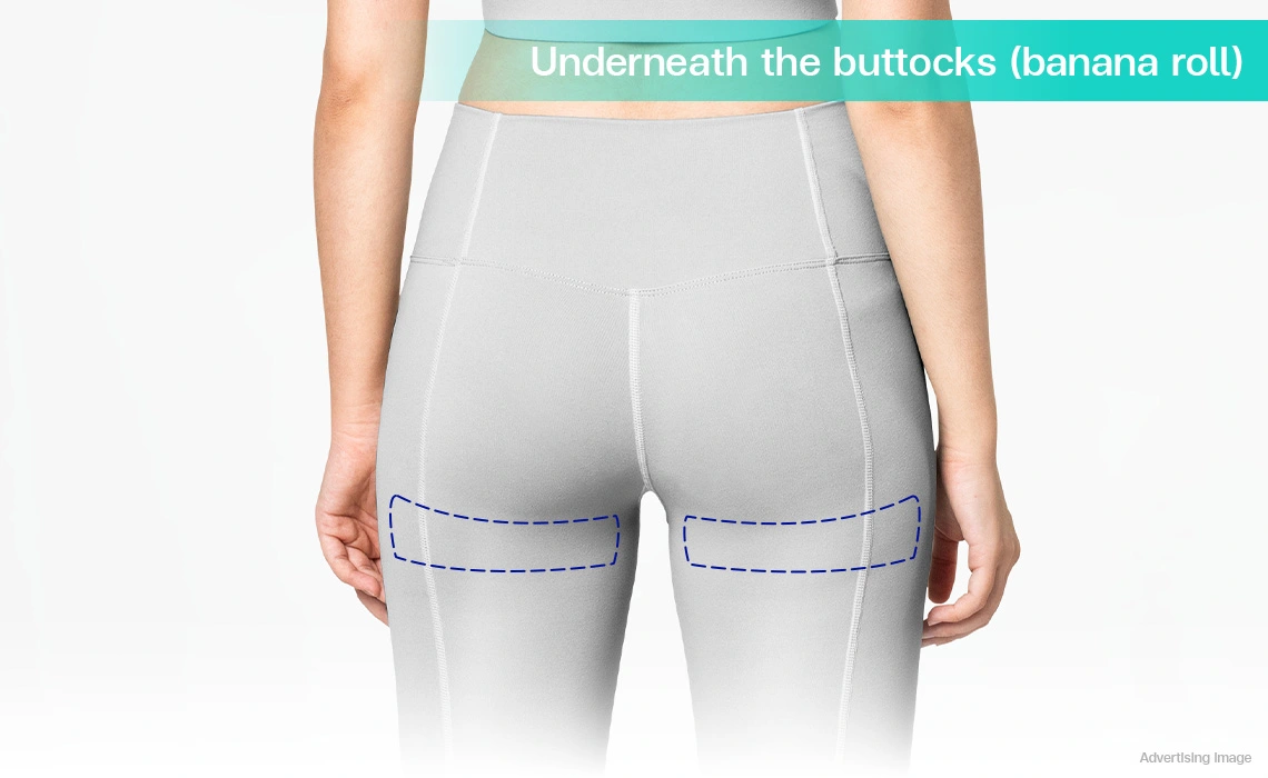 coolshaping2 banana rolls fat reduction under buttocks fat freezing for smoother glute thigh curve