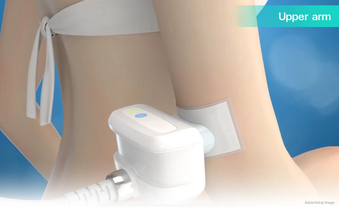 coolshaping2 fat freezing upper arm for bat wing reduction and arm slimming