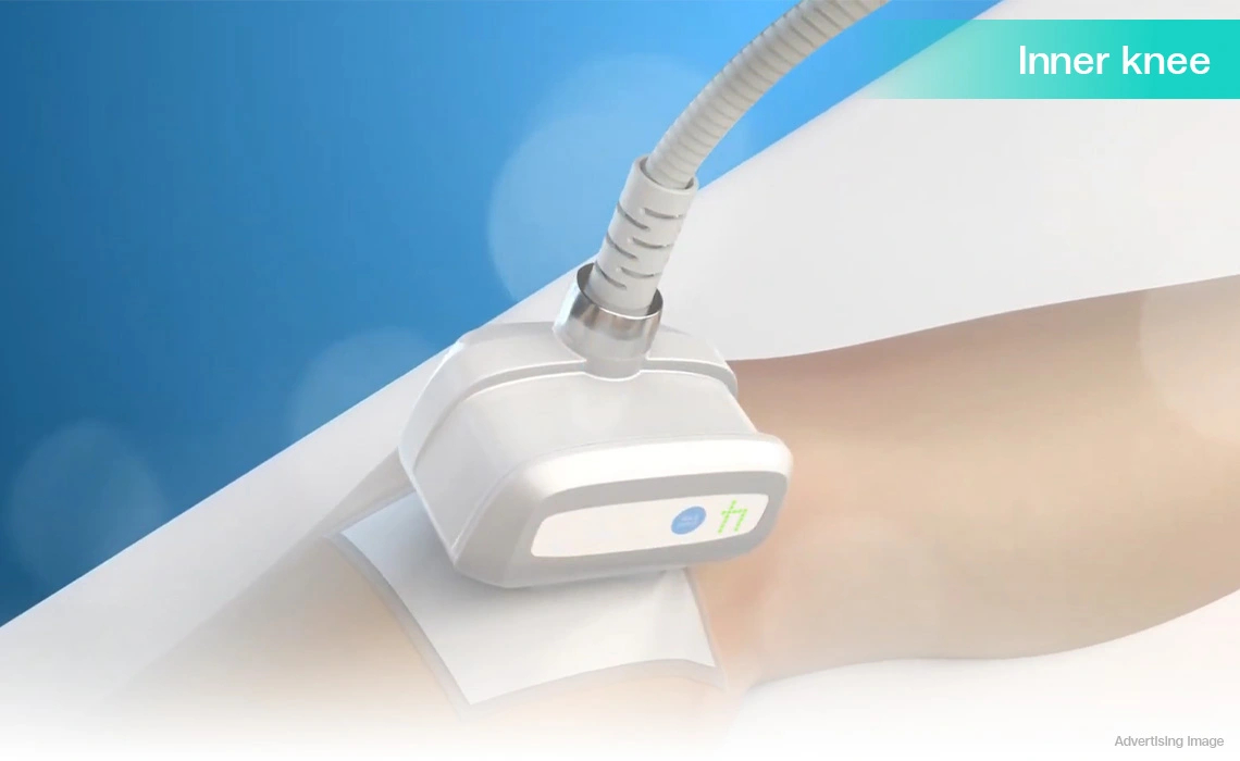 coolshaping2 inner knee fat reduction targeted fat freezing for slimmer legs body contouring
