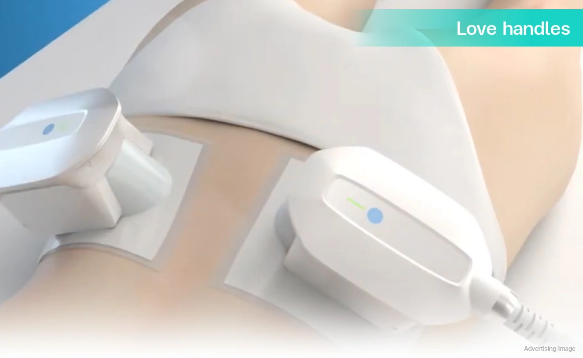 coolshaping2 program targeting love handles with applicators to reduce flank fat and shape waistline