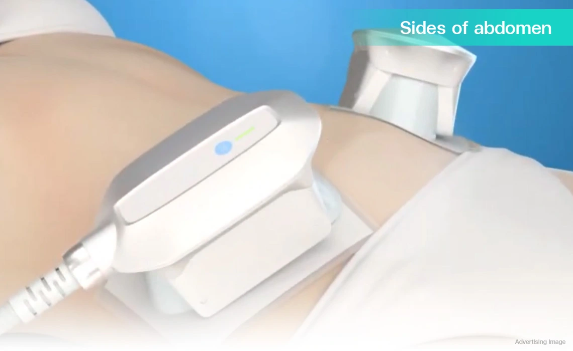 dual coolshaping2 handpieces treating abdomen sides with 360 degree fat freezing technology