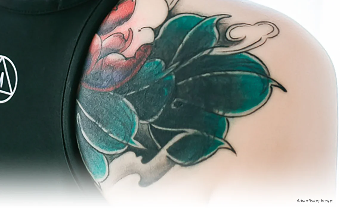 green Tattoo Removal