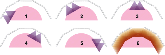 Therapy Healite II