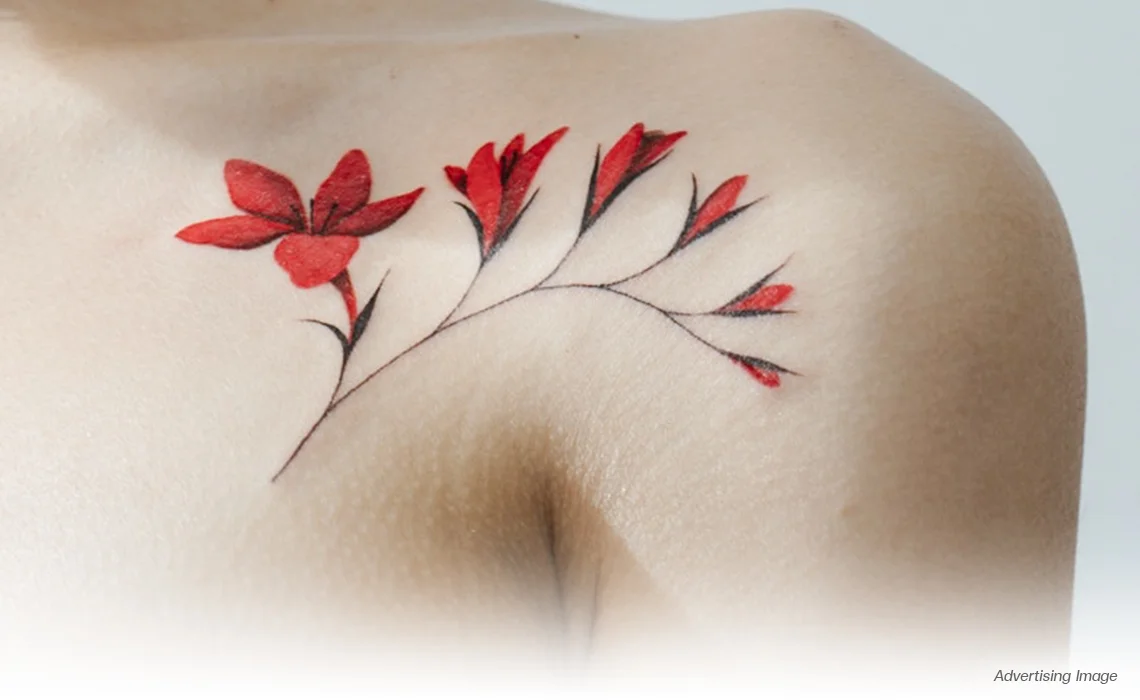 red Tattoo Removal