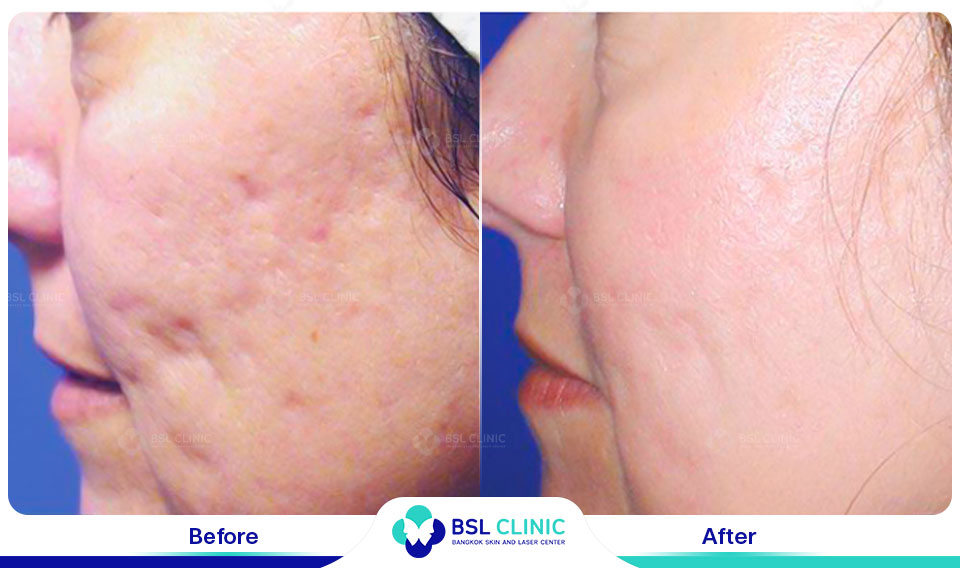 before after scars