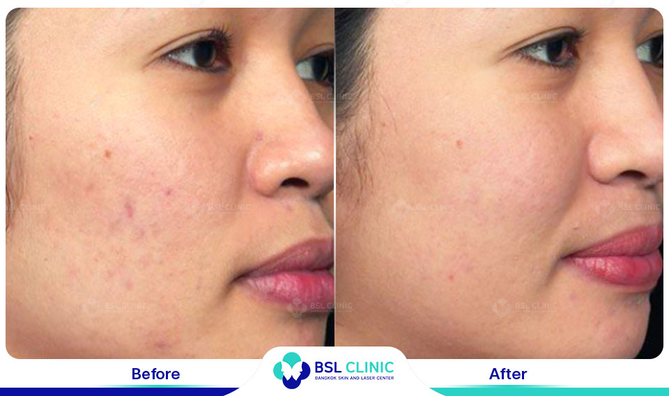 before after scars