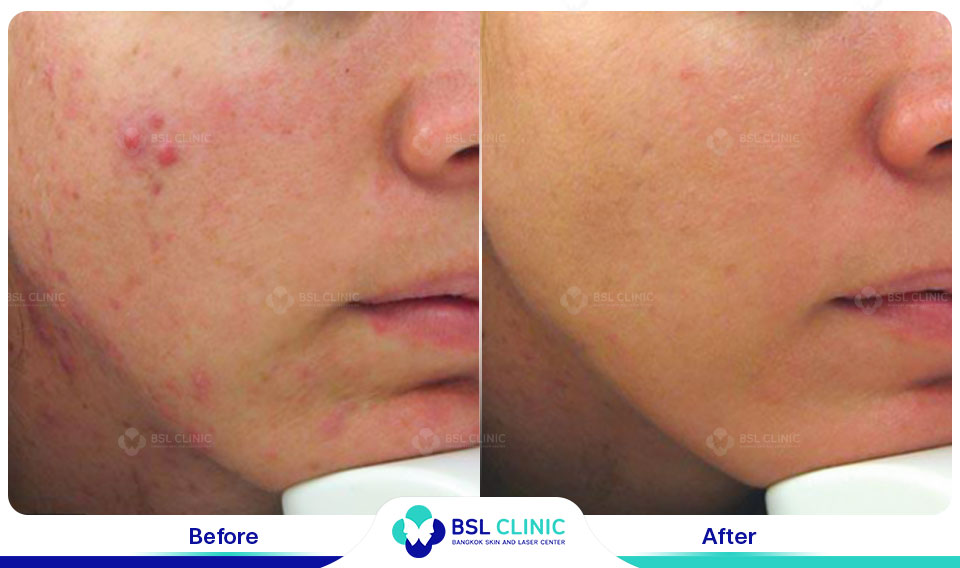 before after scars
