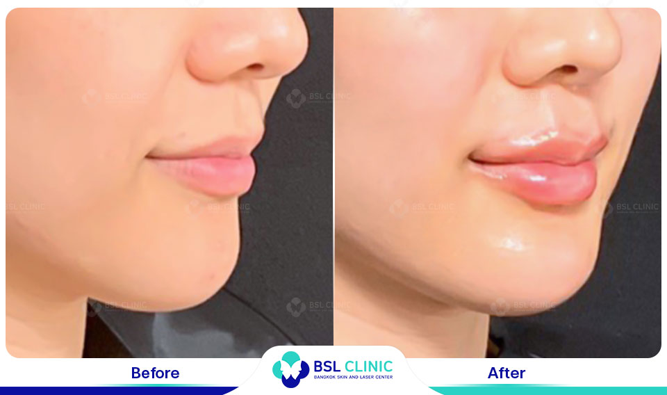 result sexy lips