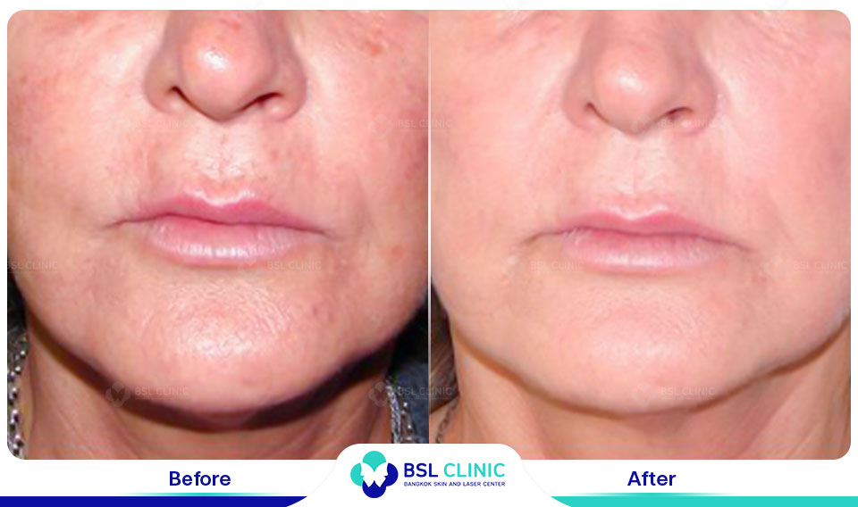 results-B&C-IPL