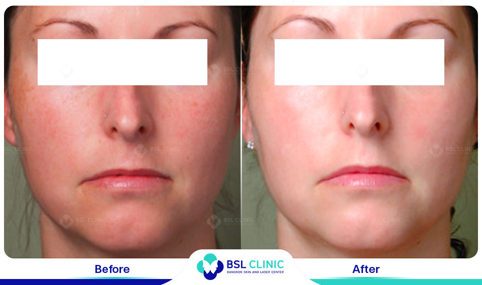 results-B&C-IPL
