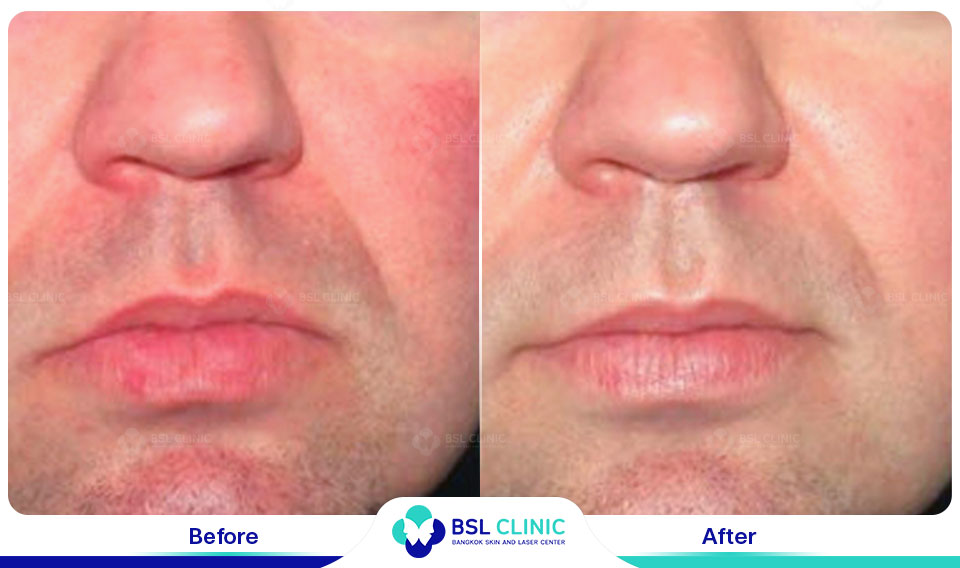 results-B&C-IPL