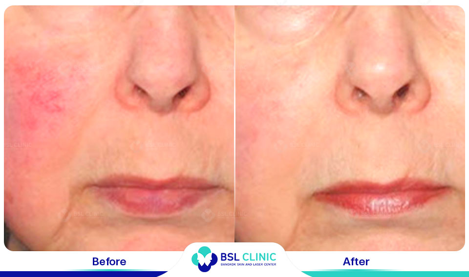 results-B&C-IPL