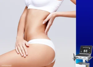ultherapy prime for body