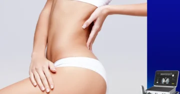 ultherapy prime for body