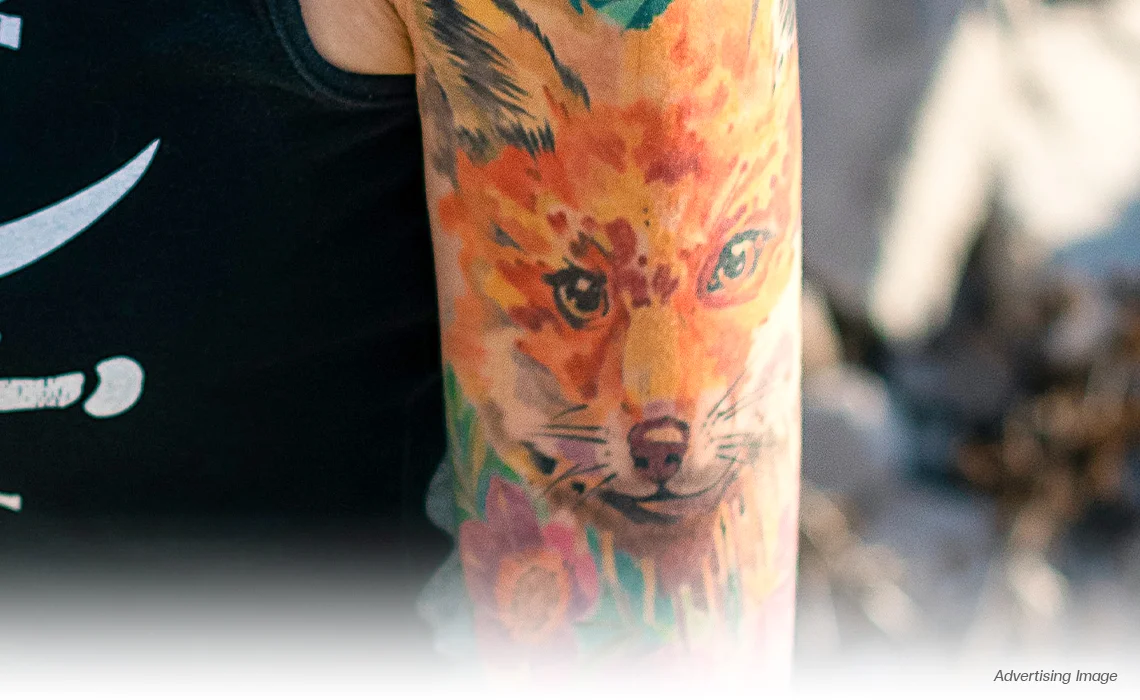 yellow Tattoo Removal