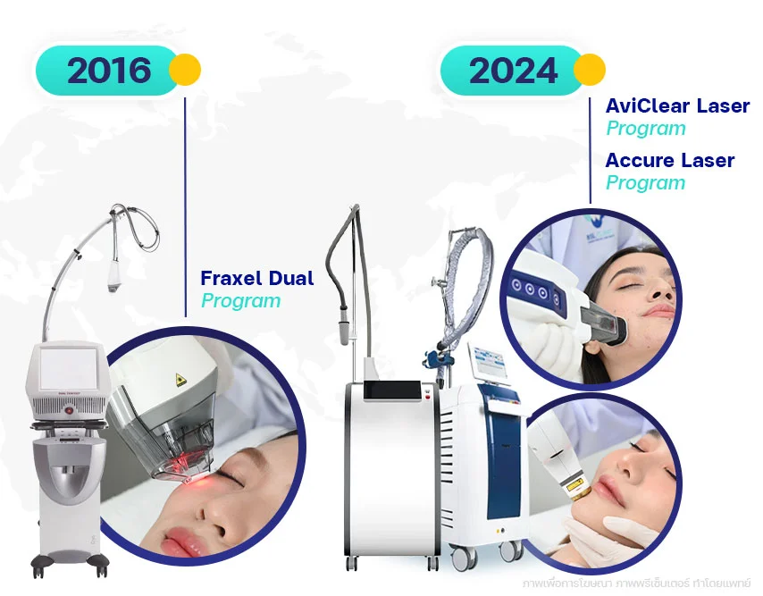 รวมวิธีรักษาสิว-เลเซอร์สิว