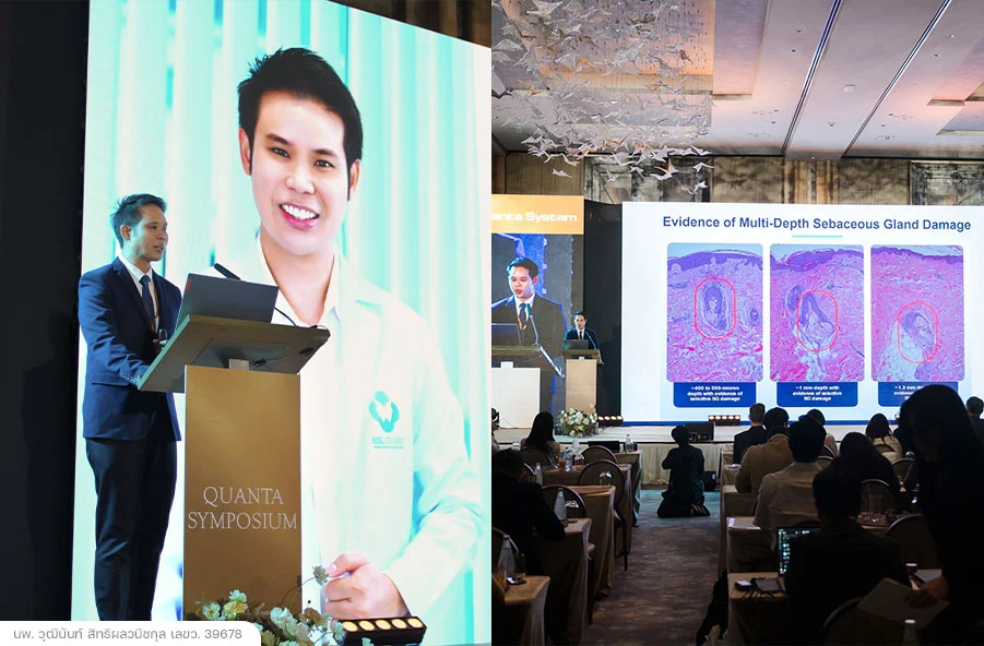 หมอวุฒิ-speaking-QuantaSymposium2026-นพ-วุฒินันท์-พญ-วิภาณี-บรรยาย-สิว