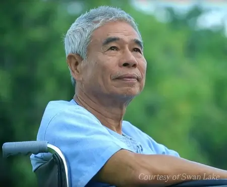 result after Seborrhoeic Keratosis Treatment