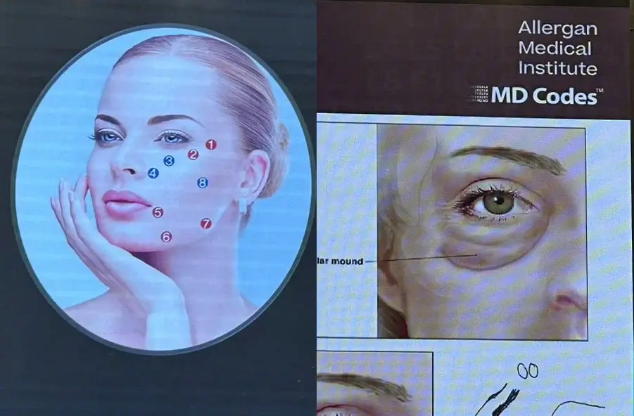 Allergan Medical Institute MD Codes Training