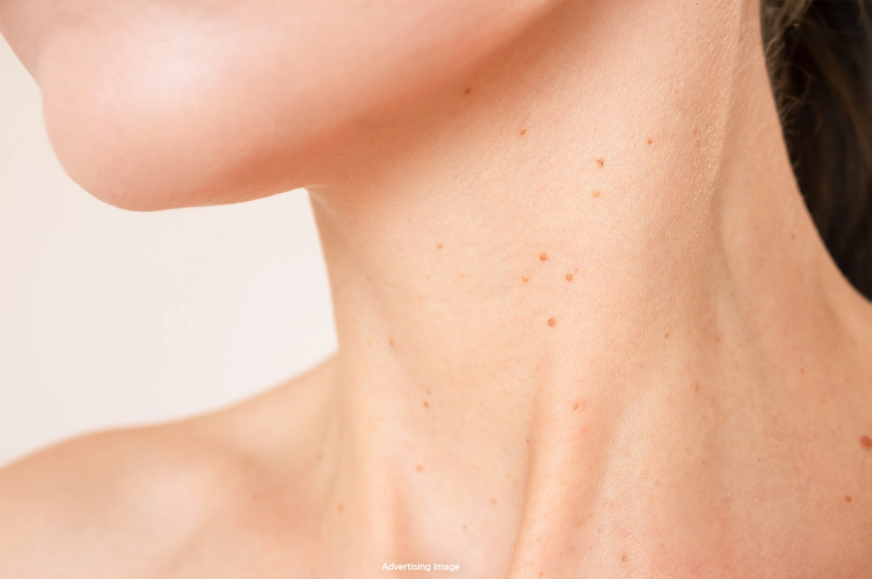 skin tag removal bangkok with co2 laser gentle treatment for moles milia syringoma at bsl clinic thailand bangkok mole removal co2 laser bangkok price skin tag removal thailand safe procedure