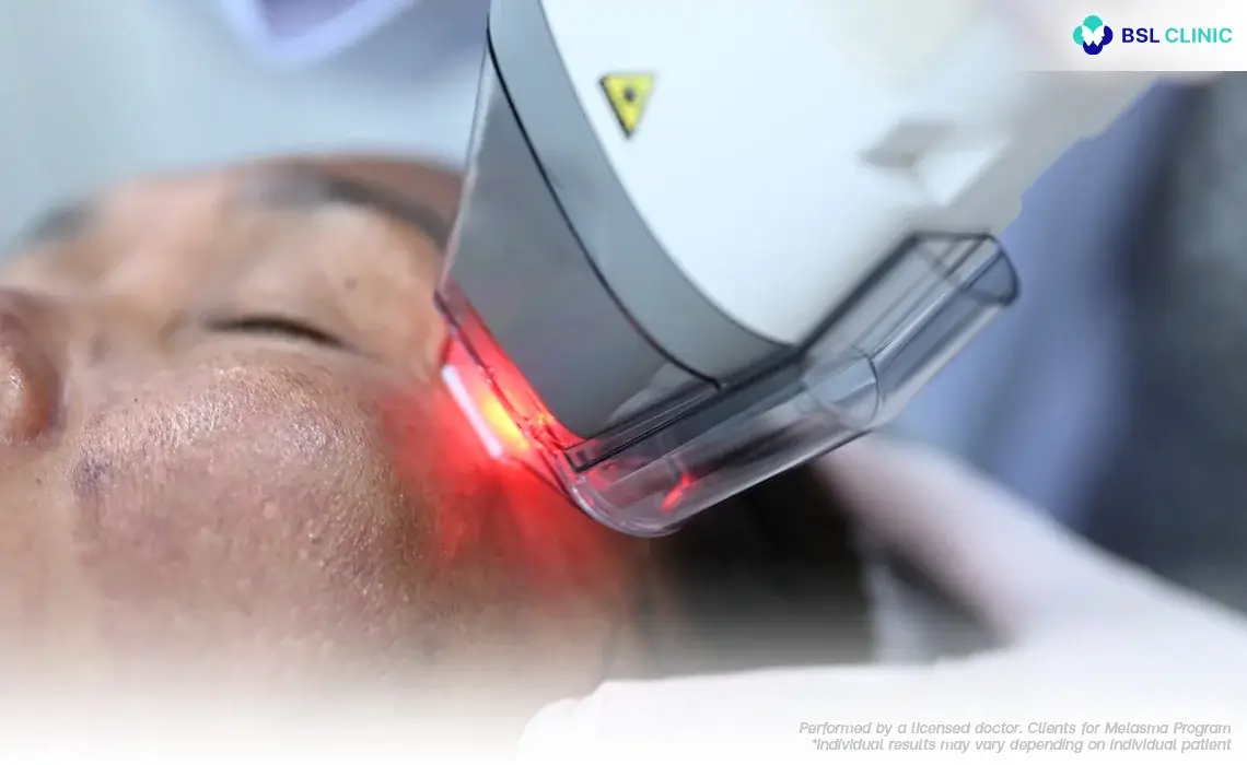 Fraxel Laser Technologies Program