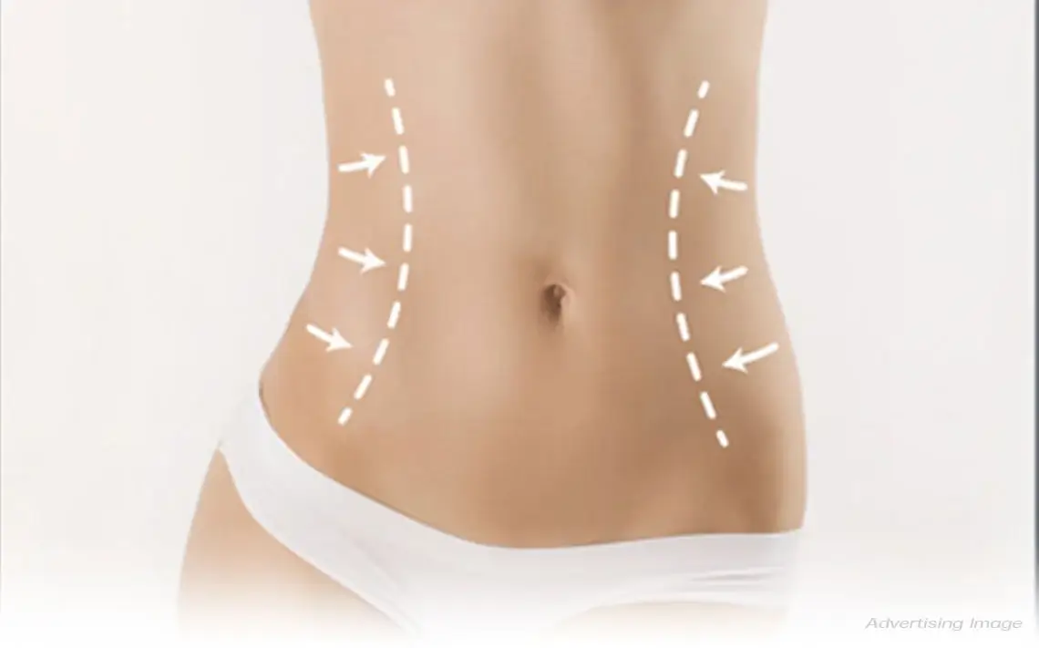 Liposuction Treatment
