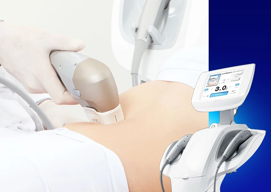 Ultraformer III related tech botdy slimming