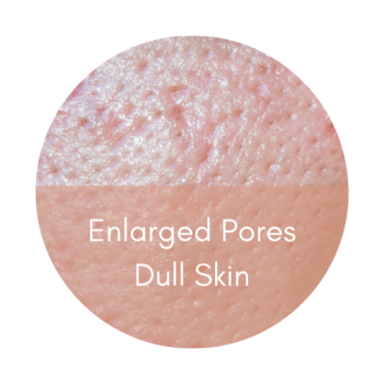 rejuran hb enlarged pores dull skin polynucleotide smooth texture rejuran black box