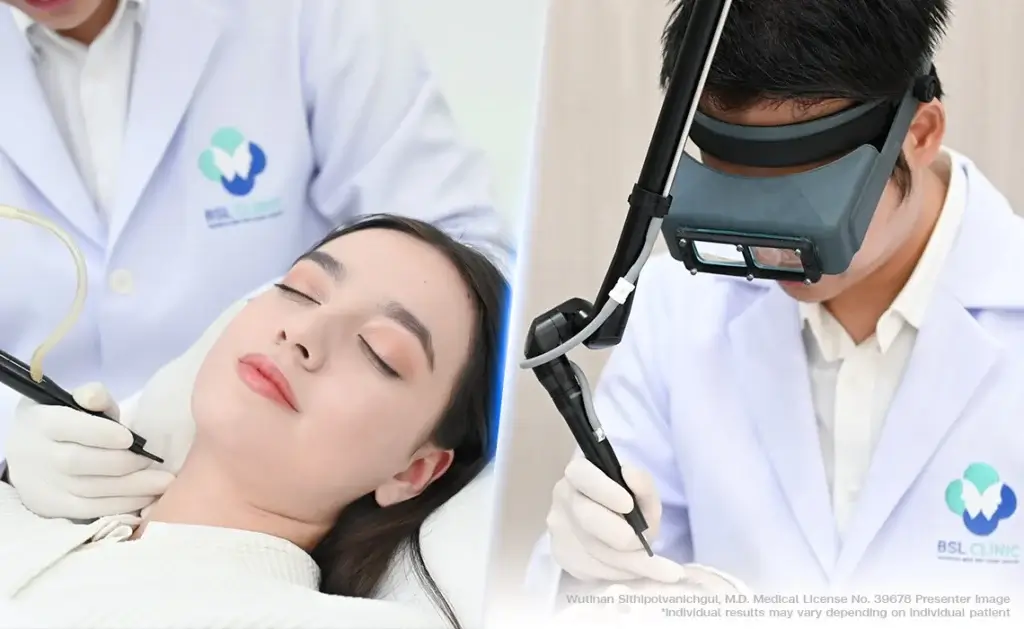 moles removal laser treatment by doctor bsl clinic selective targeting mole milia syringoma