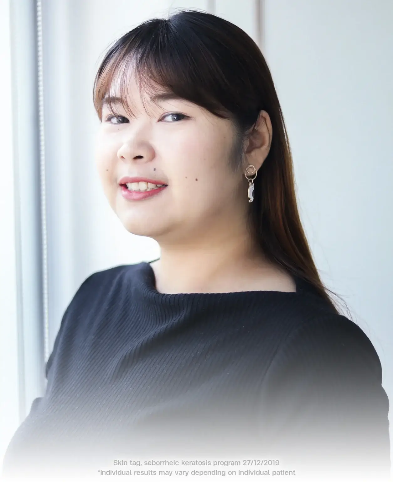 real results seborrheic keratosis and skin tag removal at bsl clinic bangkok thailand using co2 laser safe treatment for neck bumps milia syringoma and skin tag removal co2 laser bangkok price skin tag removal thailand bangkok mole removal results
