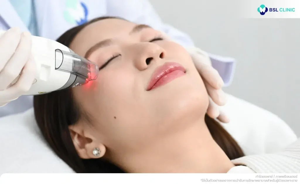 Fraxel Laser Program
