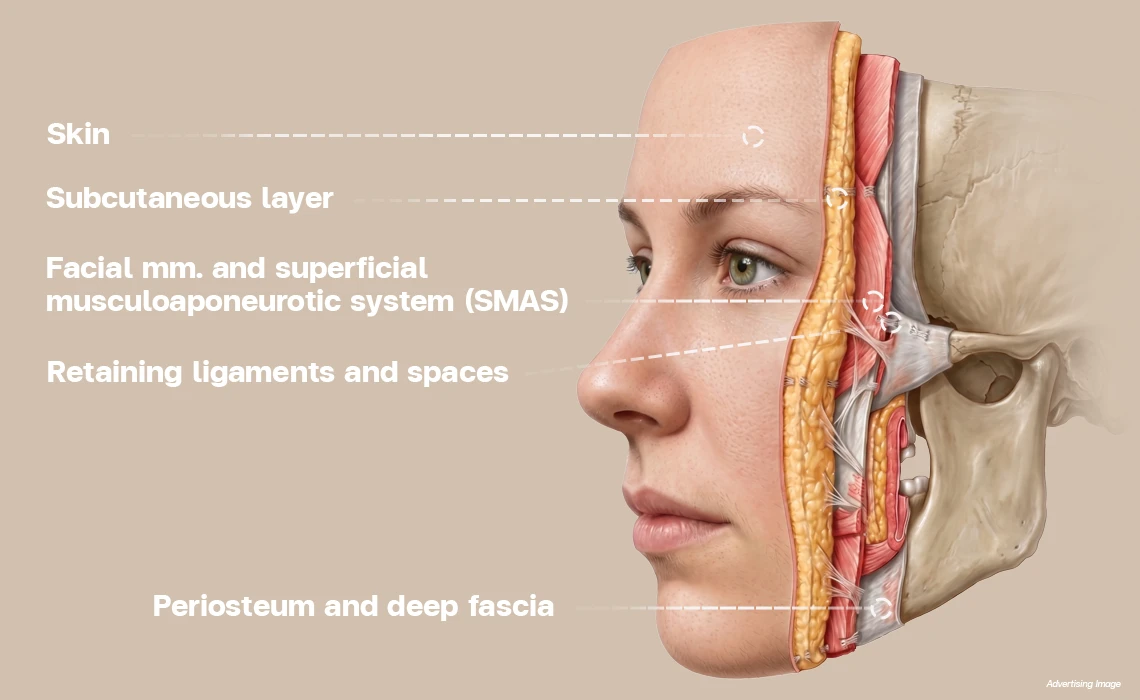 HA Filler Program Because facial aging happens across multiple layers
