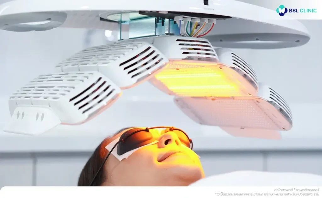 การฉายแสงลดสิว (LED Light Therapy)