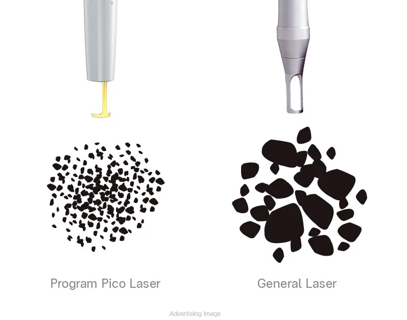 pico laser vs general laser comparison pigment fragmentation picoway laser treatment bangkok thailand