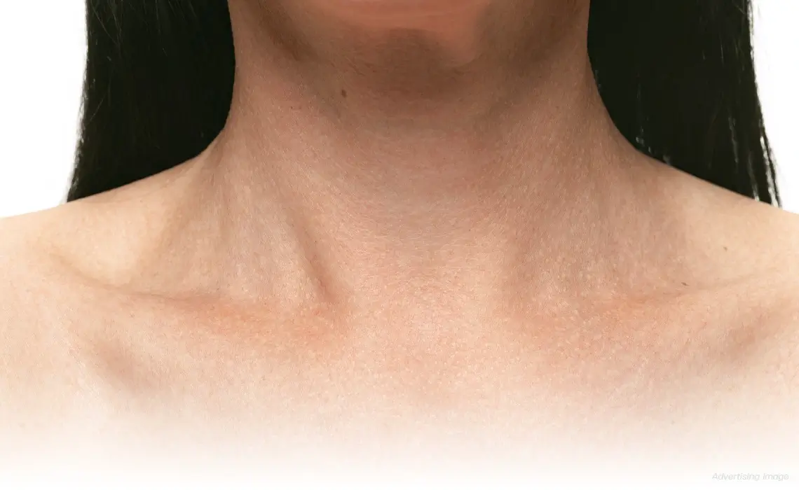 Skin Laxity Firmness