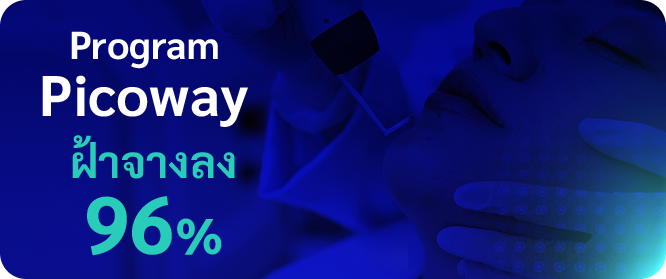 ฝ้าจางลง 96%