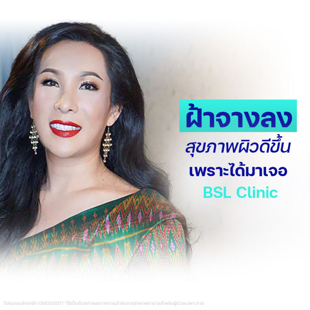 ฝ้าจางลง-รักษาฝ้า-คุณฟาร่า