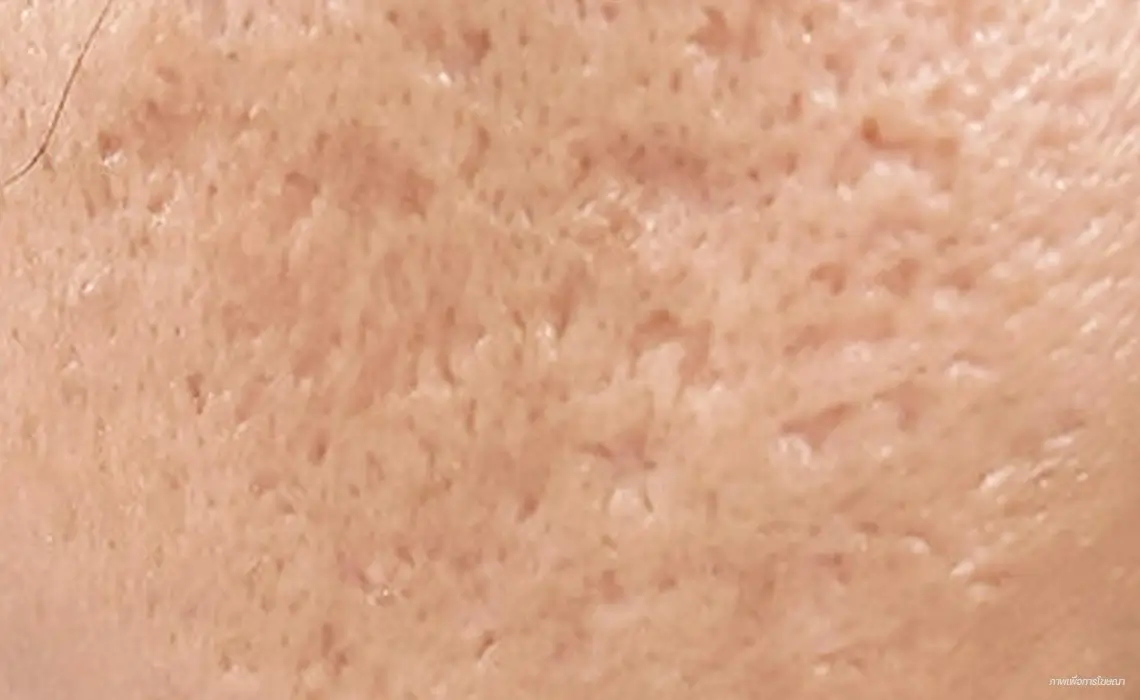 Boxcar Scar
