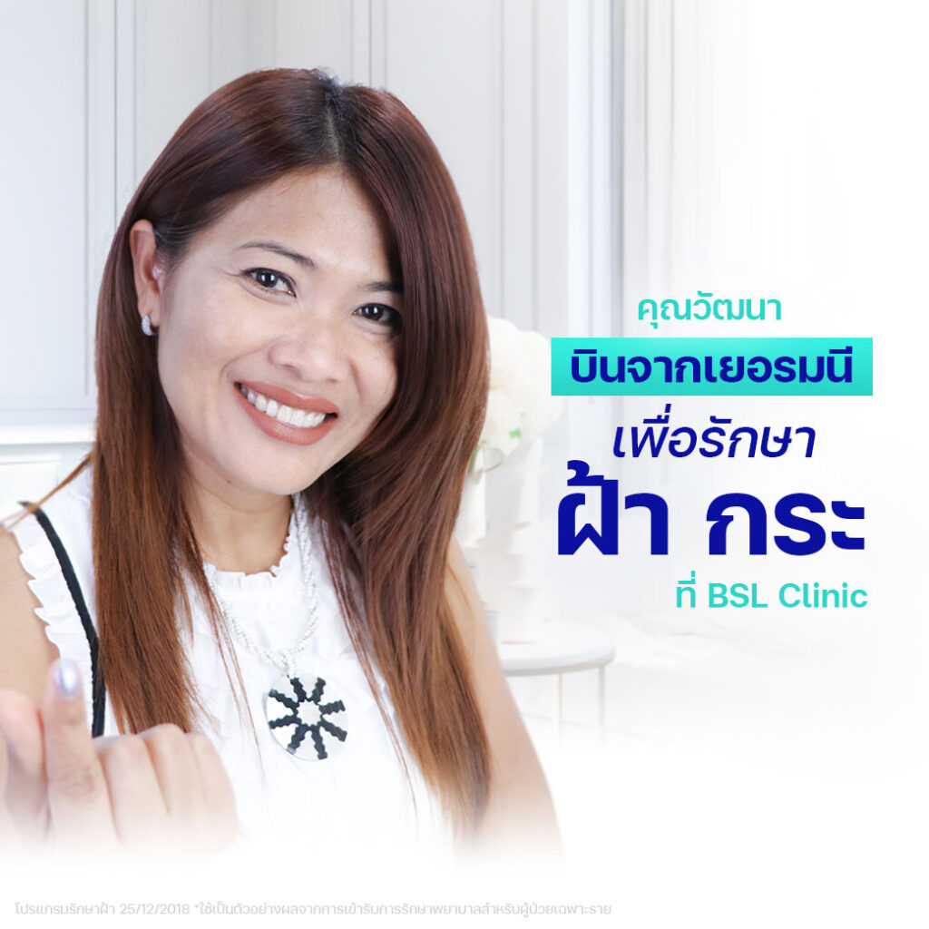 แม้อยู่ไกลแค่ไหน_ก็มาที่บีเอสแอล_รักษาฝ้า