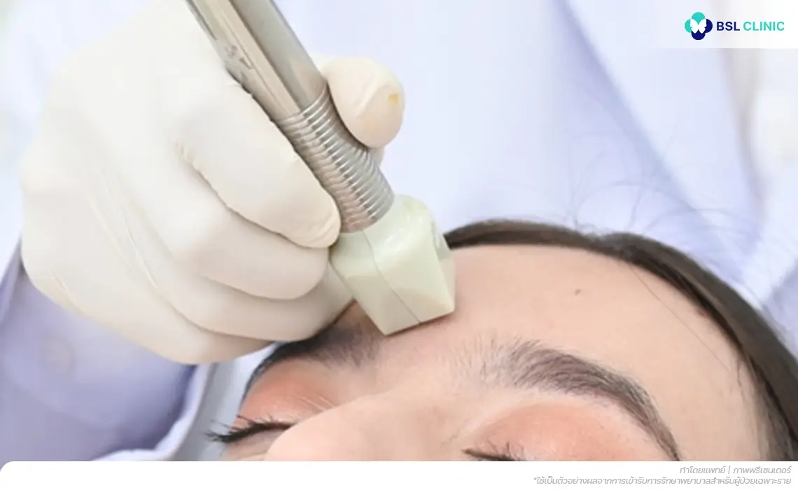 fractora program