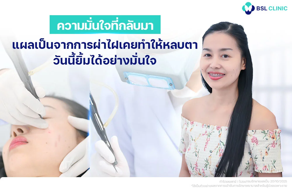 ไฝที่แก้ม