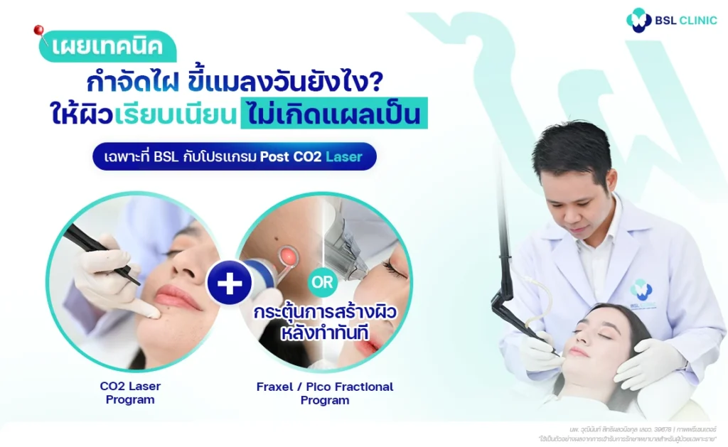 แนวทางดูแลไฝแบบผสมผสานหลัง CO2 Laser ที่ BSL